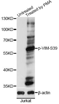 Vimentin Antibody - Western blot analysis of extracts of Jurkat cells, using Phospho-VIM-S39 antibody at 1:2000 dilution. Jurkat cells were treated by PMA/TPA (200nM) for 10 minutes. The secondary antibody used was an HRP Goat Anti-Rabbit IgG (H+L) at 1:10000 dilution. Lysates were loaded 25ug per lane and 3% nonfat dry milk in TBST was used for blocking. Blocking buffer: 3% BSA.An ECL Kit was used for detection and the exposure time was 1s.