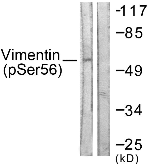 Vimentin Antibody - Western blot analysis of lysates from A549 cells treated with Nocodazole 1ug/ml 16h, using Vimentin (Phospho-Ser56) Antibody. The lane on the right is blocked with the phospho peptide.