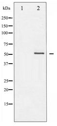 Vimentin Antibody - Western blot of Vimentin phosphorylation expression in Nocodazole treated A549 whole cell lysates,The lane on the left is treated with the antigen-specific peptide.