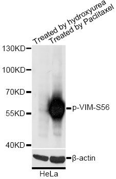 Vimentin Antibody - Western blot analysis of extracts of HeLa cells, using Phospho-VIM-S56 antibody at 1:3000 dilution. HeLa cells were treated by Hydroxyurea (4mM) for 20 hours or treated by Paclitaxel (100nM/ml) for 20 hours. The secondary antibody used was an HRP Goat Anti-Rabbit IgG (H+L) at 1:10000 dilution. Lysates were loaded 25ug per lane and 3% nonfat dry milk in TBST was used for blocking. Blocking buffer: 3% BSA.An ECL Kit was used for detection and the exposure time was 1s.