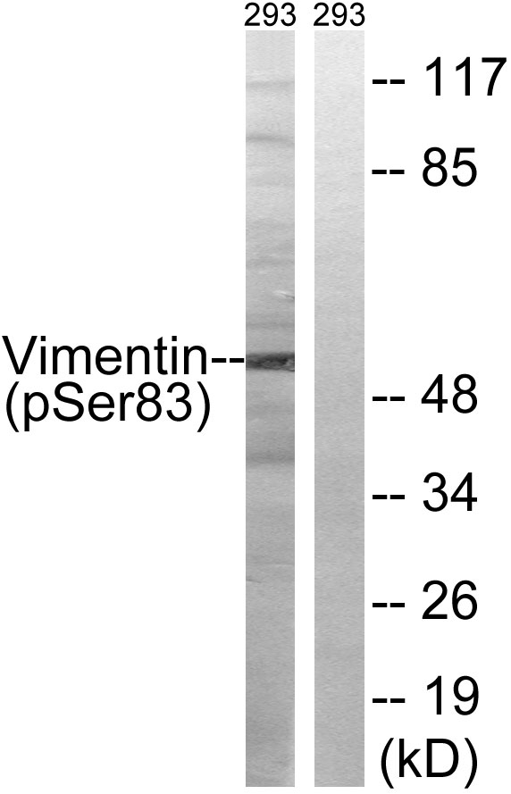 Vimentin Antibody - Western blot analysis of lysates from 293 cells treated with paclitaxel 1uM 24h, using Vimentin (Phospho-Ser83) Antibody. The lane on the right is blocked with the phospho peptide.