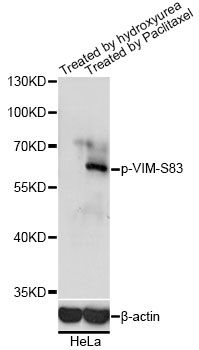 Vimentin Antibody - Western blot analysis of extracts of HeLa cells, using Phospho-VIM-S83 antibody at 1:2000 dilution. HeLa cells were treated by Hydroxyurea (4mM) for 20 hours or treated by Paclitaxel (100nM/ml) for 20 hours. The secondary antibody used was an HRP Goat Anti-Rabbit IgG (H+L) at 1:10000 dilution. Lysates were loaded 25ug per lane and 3% nonfat dry milk in TBST was used for blocking. Blocking buffer: 3% BSA.An ECL Kit was used for detection and the exposure time was 2s.