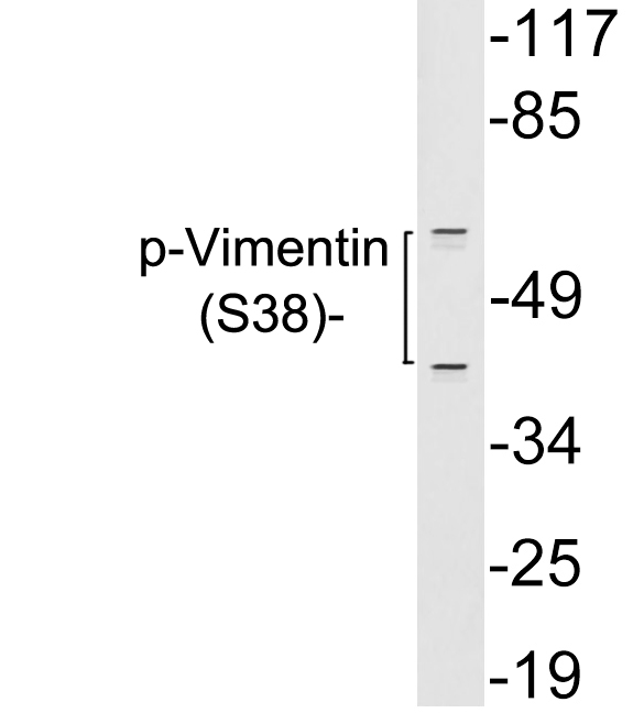 Vimentin Antibody - Western blot analysis of lysates from 293 cells treated with paclitaxel, using p-Vimentin (Phospho-Ser38) antibody.