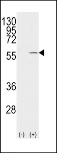 Vimentin Antibody - Western blot of VIM(arrow) using rabbit polyclonal Vimentin Antibody (S82). 293 cell lysates (2 ug/lane) either nontransfected (Lane 1) or transiently transfected with the VIM gene (Lane 2) (Origene Technologies).