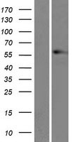 Vimentin Protein - Western validation with an anti-DDK antibody * L: Control HEK293 lysate R: Over-expression lysate