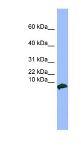 VIP Antibody - VIP antibody Western blot of PANC1 cell lysate. This image was taken for the unconjugated form of this product. Other forms have not been tested.