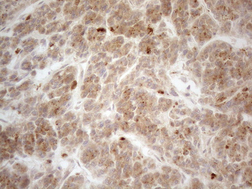 VIP Antibody - Immunohistochemical staining of paraffin-embedded Human liver tissue using anti-VIP mouse monoclonal antibody. (Heat-induced epitope retrieval by 1mM EDTA in 10mM Tris buffer. (pH8.5) at 120°C for 3 min. (1:150)