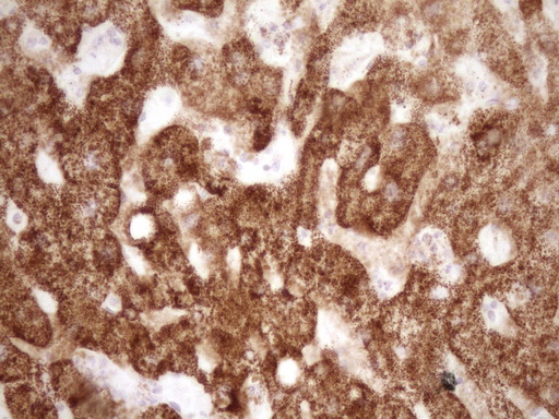 VIP Antibody - IHC of paraffin-embedded Human liver tissue using anti-VIP mouse monoclonal antibody. (Heat-induced epitope retrieval by 1 mM EDTA in 10mM Tris, pH8.5, 120°C for 3min).