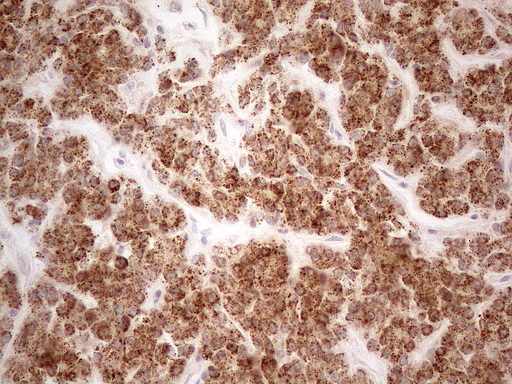 VIP Antibody - Immunohistochemical staining of paraffin-embedded Human liver tissue using anti-VIP mouse monoclonal antibody. (Heat-induced epitope retrieval by 1mM EDTA in 10mM Tris buffer. (pH8.5) at 120°C for 3 min. (1:150)