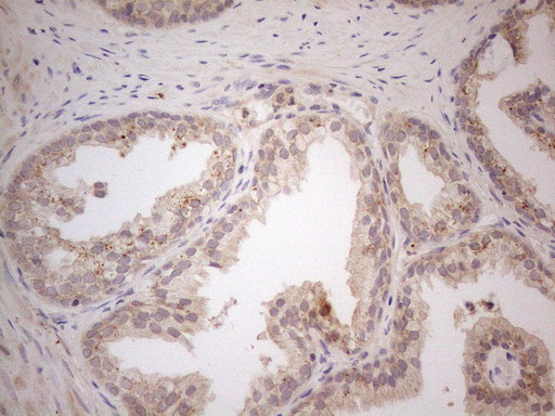VIP Antibody - Immunohistochemical staining of paraffin-embedded Human prostate tissue using anti-VIP mouse monoclonal antibody. (Heat-induced epitope retrieval by 1mM EDTA in 10mM Tris buffer. (pH8.5) at 120°C for 3 min. (1:150)