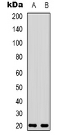 VIP Antibody - Western blot analysis of VIP expression in rat muscle (A); rat kidney (B) whole cell lysates.