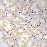 VIP Antibody - Immunohistochemical analysis of VIP staining in human kidney formalin fixed paraffin embedded tissue section. The section was pre-treated using heat mediated antigen retrieval with sodium citrate buffer (pH 6.0). The section was then incubated with the antibody at room temperature and detected using an HRP polymer system. DAB was used as the chromogen. The section was then counterstained with hematoxylin and mounted with DPX.