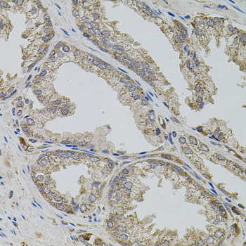 VIP Antibody - Immunohistochemistry of paraffin-embedded human prostate using VIP antibody (40x lens).