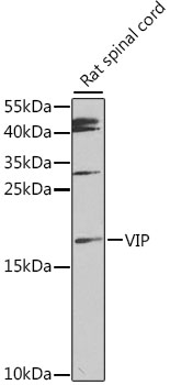 VIP Antibody - Western blot analysis of extracts of rat spinal cord, using VIP antibody at 1:1000 dilution. The secondary antibody used was an HRP Goat Anti-Rabbit IgG (H+L) at 1:10000 dilution. Lysates were loaded 25ug per lane and 3% nonfat dry milk in TBST was used for blocking. An ECL Kit was used for detection and the exposure time was 90s.