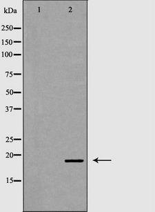 VIP Antibody - Western blot analysis of extracts of Jurkat cells using VIP antibody. The lane on the left is treated with the antigen-specific peptide.