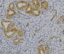 VIP Antibody - 1:100 staining human uterus tissue by IHC-P. The sample was formaldehyde fixed and a heat mediated antigen retrieval step in citrate buffer was performed. The sample was then blocked and incubated with the antibody for 1.5 hours at 22°C. An HRP conjugated goat anti-rabbit antibody was used as the secondary.
