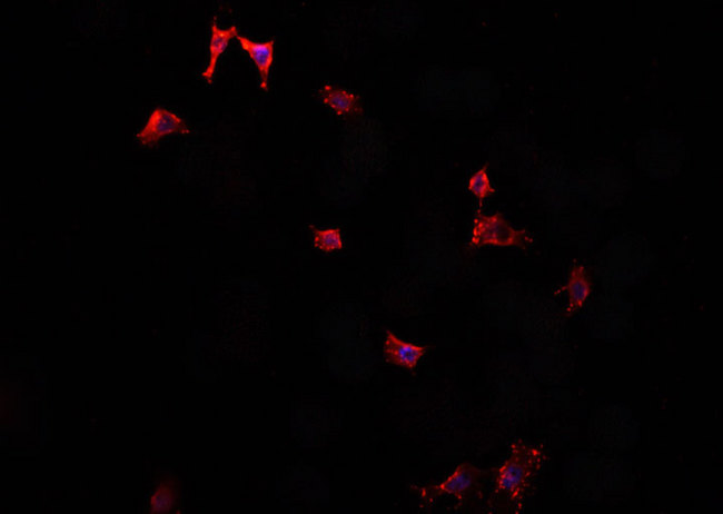 VIP Antibody - Staining HepG2 cells by IF/ICC. The samples were fixed with PFA and permeabilized in 0.1% Triton X-100, then blocked in 10% serum for 45 min at 25°C. The primary antibody was diluted at 1:200 and incubated with the sample for 1 hour at 37°C. An Alexa Fluor 594 conjugated goat anti-rabbit IgG (H+L) antibody, diluted at 1/600, was used as secondary antibody.