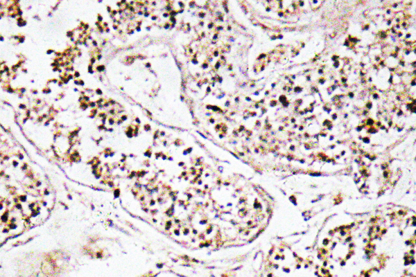 VIP Antibody - IHC of VIP (V120) pAb in paraffin-embedded human testis tissue.
