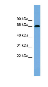 VIPAS39 Antibody - VIPAR antibody Western blot of Fetal lung lysate. This image was taken for the unconjugated form of this product. Other forms have not been tested.