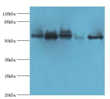 VIPAS39 Antibody - Western blot. All lanes: VIPAS39 antibody at 12 ug/ml. Lane 1: HepG2 cells. Lane 2: A431 cells. Lane 3: 293T cells. Lane 4: mouse kidney tissue. Lane 5: HeLa cells. Secondary antibody: Goat polyclonal to rabbit at 1:10000 dilution. Predicted band size: 57 kDa. Observed band size: 57 kDa.