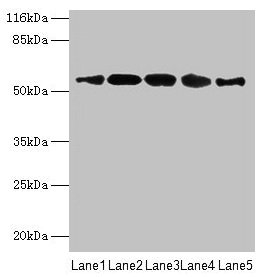 VIPAS39 Antibody - Western blot All lanes: VIPAS39 antibody at 12µg/ml Lane 1: HepG2 whole cell lysate Lane 2: A431 whole cell lysate Lane 3: 293T whole cell lysate Lane 4: Mouse kidney tissue Lane 5: Hela whole cell lysate Secondary Goat polyclonal to rabbit IgG at 1/10000 dilution Predicted band size: 58, 52 kDa Observed band size: 58 kDa