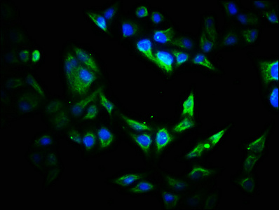VIPAS39 Antibody - Immunofluorescence staining of Hela cells with VIPAS39 Antibody at 1:200, counter-stained with DAPI. The cells were fixed in 4% formaldehyde, permeabilized using 0.2% Triton X-100 and blocked in 10% normal Goat Serum. The cells were then incubated with the antibody overnight at 4°C. The secondary antibody was Alexa Fluor 488-congugated AffiniPure Goat Anti-Rabbit IgG(H+L).