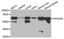 VIPAS39 Antibody - Western blot analysis of extracts of various cell lines.