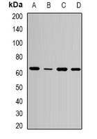 VIPAS39 Antibody - Western blot analysis of SPE39 expression in MCF7 (A); HepG2 (B); mouse liver (C); mouse kidney (D) whole cell lysates.