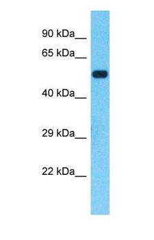 VIPAS39 Antibody - Western blot of VIPAS39 Antibody with Fetal Lung lysate.  This image was taken for the unconjugated form of this product. Other forms have not been tested.