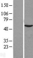 VIPAS39 Protein - Western validation with an anti-DDK antibody * L: Control HEK293 lysate R: Over-expression lysate