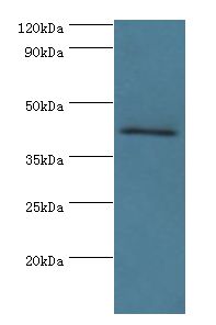 VIPERIN / RSAD2 Antibody - Western blot. All lanes: RSAD2 antibody at 8 ug/ml+Jurkat whole cell lysate. Secondary antibody: Goat polyclonal to rabbit at 1:10000 dilution. Predicted band size: 42 kDa. Observed band size: 42 kDa.
