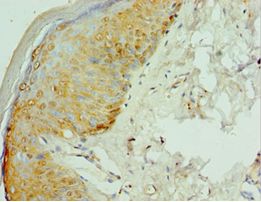 VIPERIN / RSAD2 Antibody - Immunohistochemistry of paraffin-embedded human skin using antibody at 1:100 dilution.