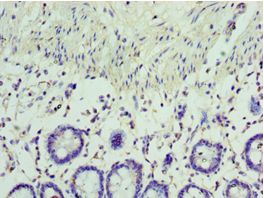 VIPERIN / RSAD2 Antibody - Immunohistochemistry of paraffin-embedded human rectum using antibody at 1:100 dilution.