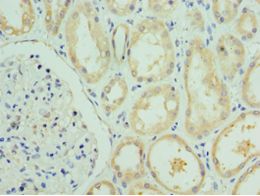 VIPERIN / RSAD2 Antibody - Immunohistochemistry of paraffin-embedded human kidney using antibody at 1:100 dilution.