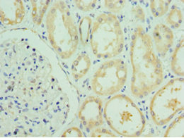 VIPERIN / RSAD2 Antibody - Immunohistochemistry of paraffin-embedded human kidney tissue using RSAD2 Antibody at dilution of 1:100