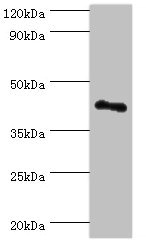 VIPERIN / RSAD2 Antibody - Western blot All lanes: RSAD2 antibody at 8µg/ml + Jurkat whole cell lysate Secondary Goat polyclonal to rabbit IgG at 1/10000 dilution Predicted band size: 42 kDa Observed band size: 42 kDa