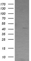 VIPERIN / RSAD2 Antibody - HEK293T cells were transfected with the pCMV6-ENTRY control (Left lane) or pCMV6-ENTRY RSAD2 (Right lane) cDNA for 48 hrs and lysed. Equivalent amounts of cell lysates (5 ug per lane) were separated by SDS-PAGE and immunoblotted with anti-RSAD2.