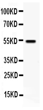 VIPR1 Antibody - Western blot - Anti-VIP Receptor 1 Antibody