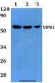 VIPR1 Antibody - Western blot of VIPR1 antibody at 1:500 dilution. Lane 1: A549 whole cell lysate. Lane 2: H9C2 whole cell lysate. Lane 3: Raw264.7 whole cell lysate.