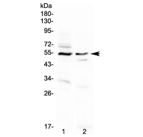 VIPR1 Antibody - Western blot testing of human 1) A431 and 2) PANC-1 cell lysate with VIPR1 antibody. Predicted molecular weight ~52 kDa.