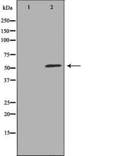 VIPR1 Antibody - Western blot analysis of extracts of HT29 cells using VIPR1 antibody. The lane on the left is treated with the antigen-specific peptide.
