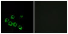VIPR1 Antibody - Peptide - + Immunofluorescence analysis of MCF-7 cells, using VIPR1 antibody.