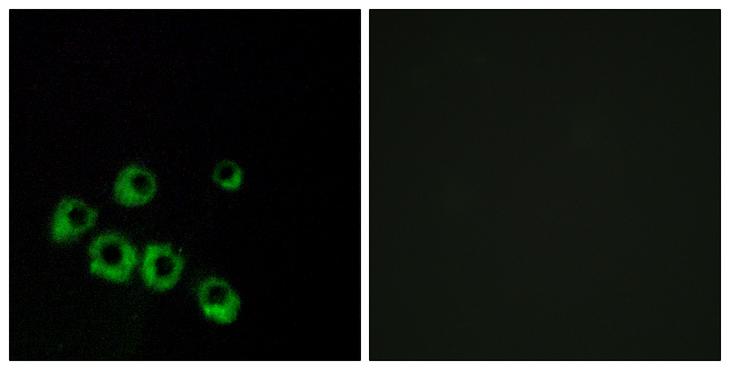 VIPR1 Antibody - Peptide - + Immunofluorescence analysis of MCF-7 cells, using VIPR1 antibody.