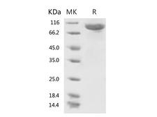 HKU1-CoV S1 Protein - Recombinant 2019-nCoV S1 Protein (His Tag)-Elabscience