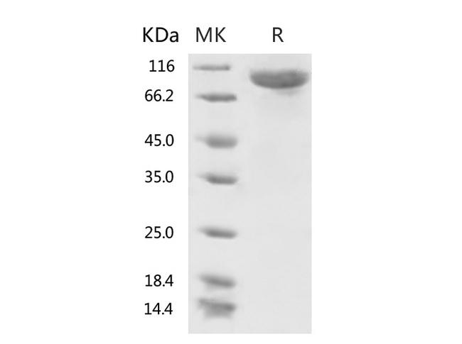 HKU1-CoV S1 Protein - Recombinant 2019-nCoV S1 Protein (His Tag)-Elabscience