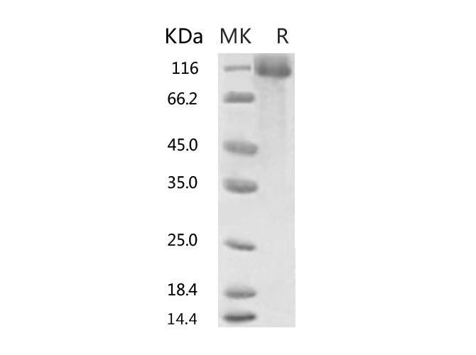 HKU1-CoV S1 Protein - Recombinant 2019-nCoV S1 Protein, Biotinylated (His Tag)-Elabscience