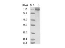 HKU1-CoV S1 Protein - Recombinant 2019-nCoV S1 Protein, Biotinylated (His Tag)-Elabscience