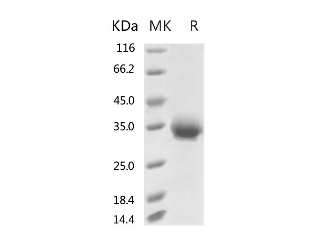 HKU1-CoV S1 Protein - Recombinant 2019-nCoV Spike Protein (RBD, His Tag)(V367F)-Elabscience