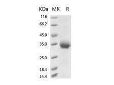 HKU1-CoV S1 Protein - Recombinant 2019-nCoV Spike Protein (RBD, His Tag)(V367F)-Elabscience