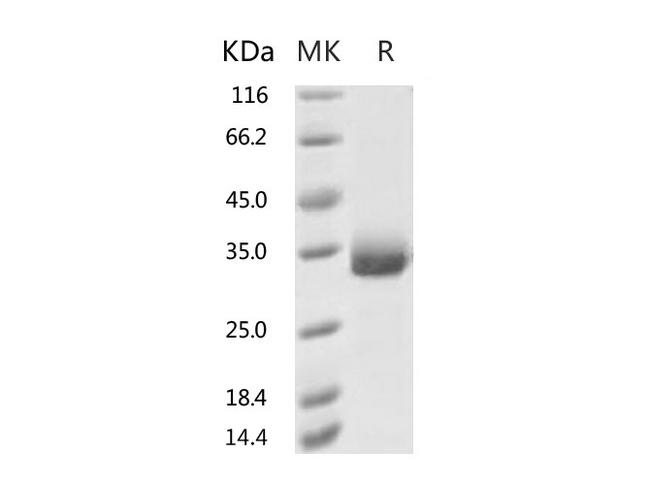 HKU1-CoV S1 Protein - Recombinant 2019-nCoV Spike Protein (RBD, His Tag)(K458R)-Elabscience